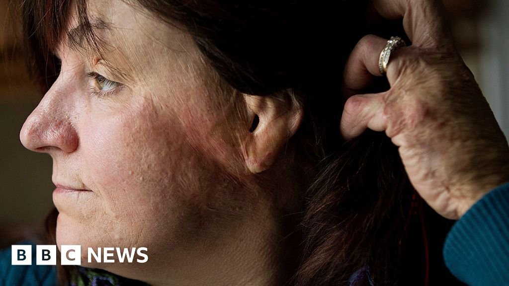 A Nightclub Inferno: How I Escaped a Devastating Blaze in Just 90 Seconds