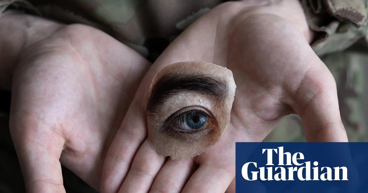 Beyond the Battlefield: A Visual Exploration of Ukraine's Healing Journey After War
